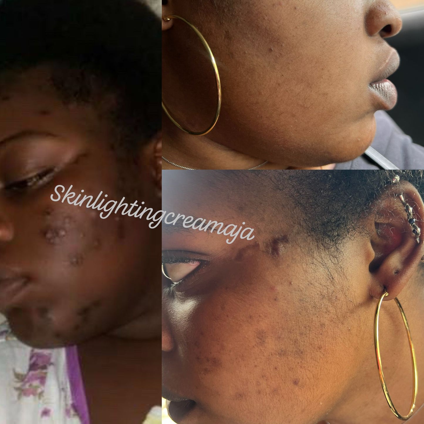 Bump & spot remover face cream skin care