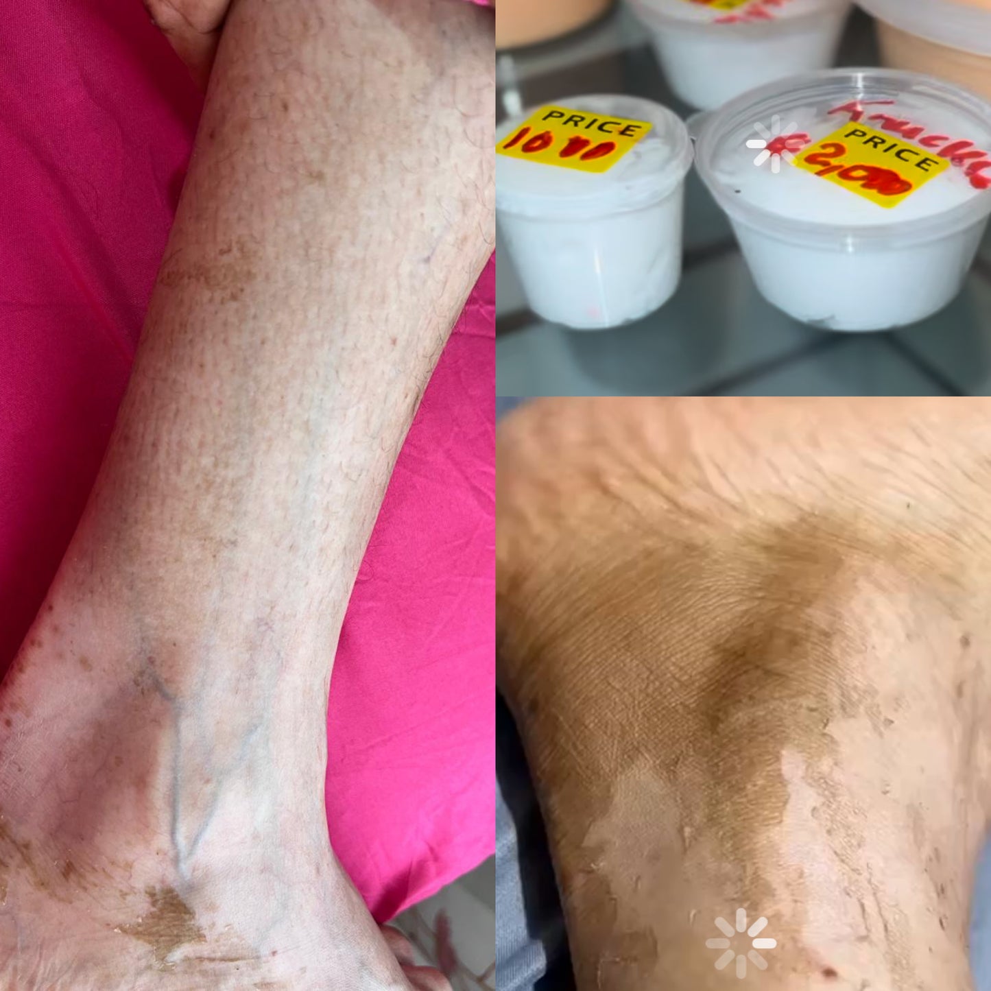 For dark areas, under arm , your finger knuckles feet’s etc. This is Pealing Knuckle cream. bleaching cream Let dark areas comes lighter 1oz