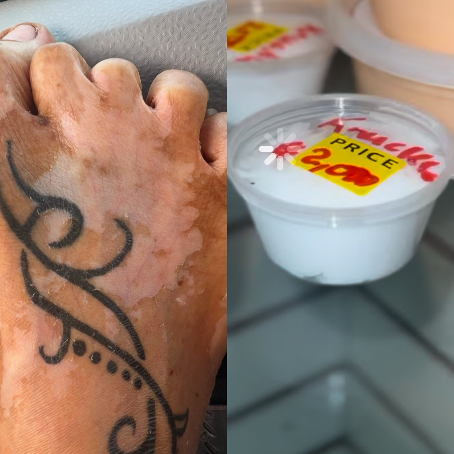 2oz Knuckle cream. This cream is made to remove dark layers making them whiter than normal. Apply 3 times daily cover with socks. Use at your own risk. Do not use it on your face very strong