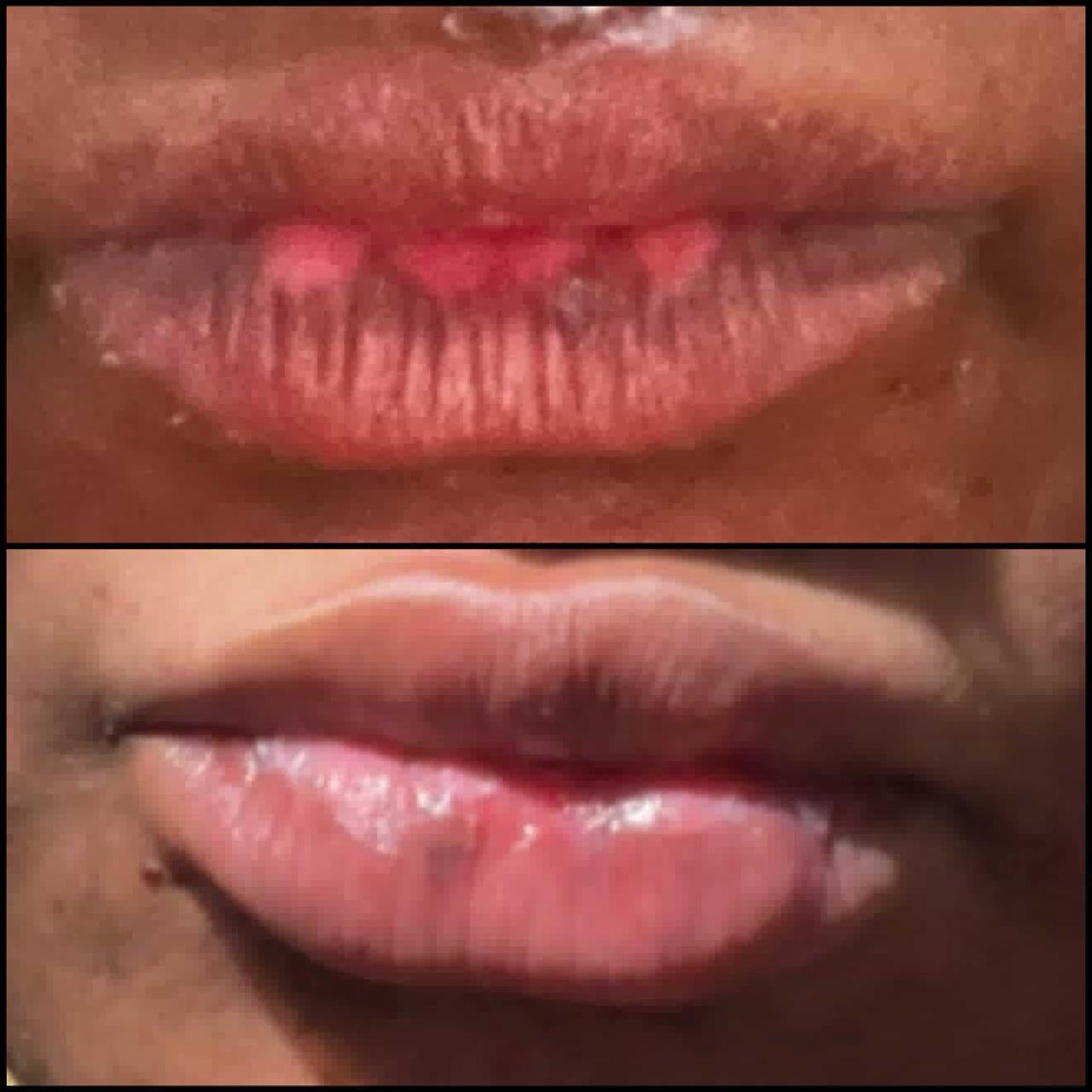 Lip cream (pink color cream) bleaching cream 1oz