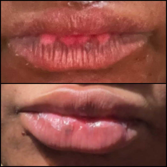 Lip cream (pink color cream) bleaching cream 1oz